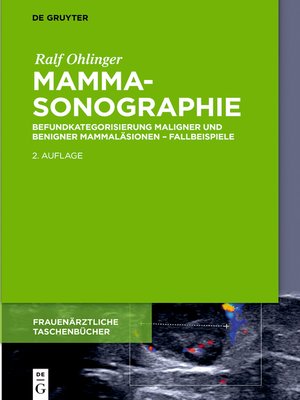 cover image of Mammasonographie